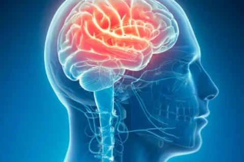 Image of brain