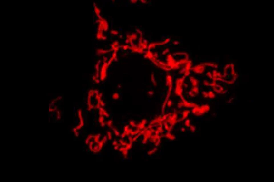 ATP Production and Mitochondrial Diseases: Mitochondria Lean Structure