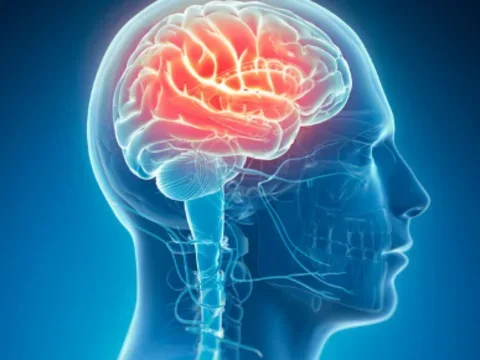 Image of brain
