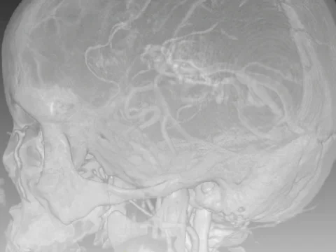Brain Picture
