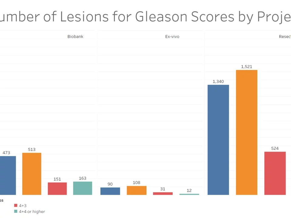 A Bar Chart of the number of lesions associated per Gleason Score, divided per cohort.