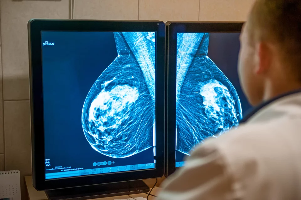 IDx Breast