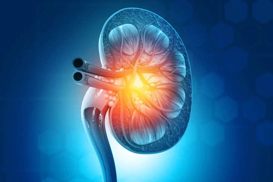 IDx Kidney
