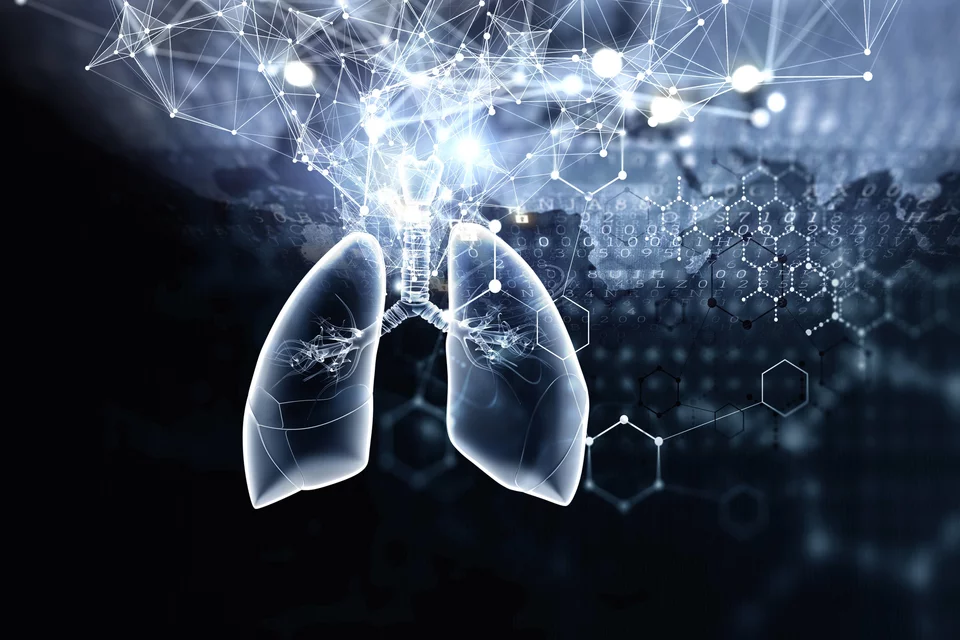 IDx Lung